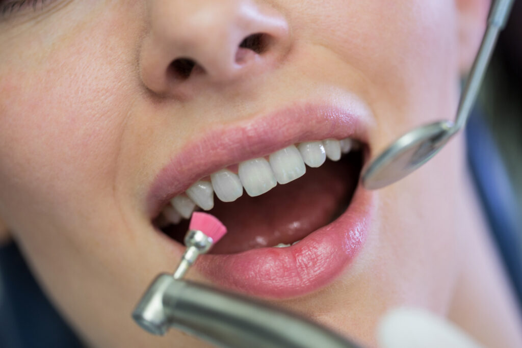Guide to Maintaining Your Veneers Through Seasonal Changes